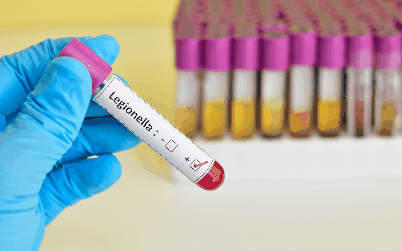 Legionella Risk Assessment Frequency